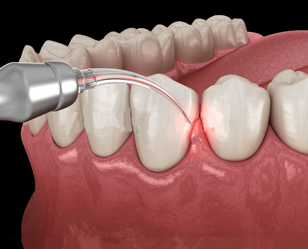 Understand the Importance of Dental Care | Dental Zone