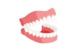 teeth-Cosmetic-Bonding