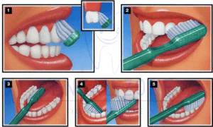 Brushing Method