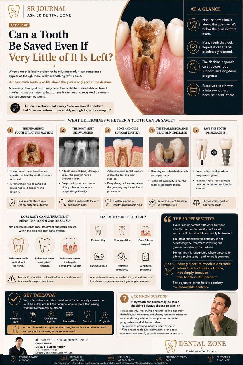 Can a Tooth Be Saved Even If Very Little Is Left?