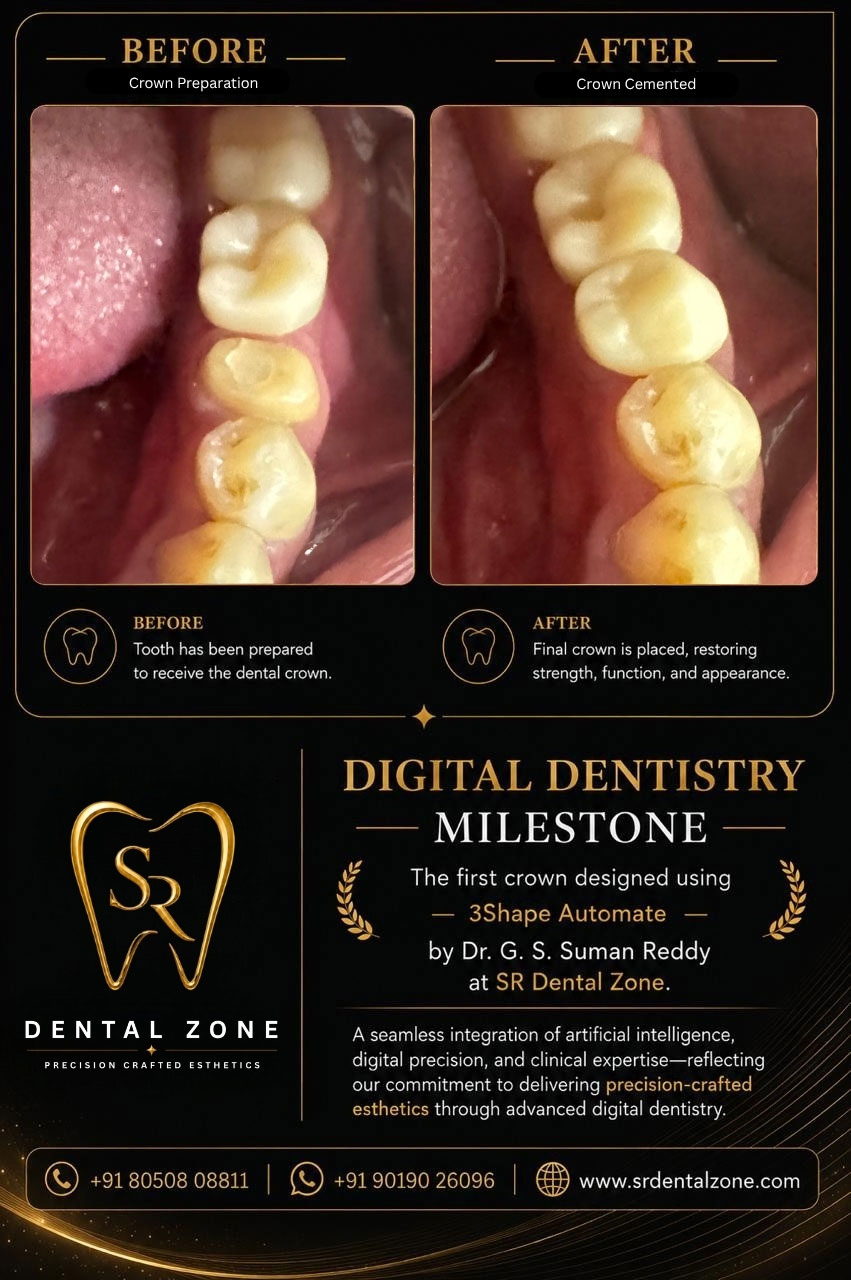 Precision dentistry Bangalore