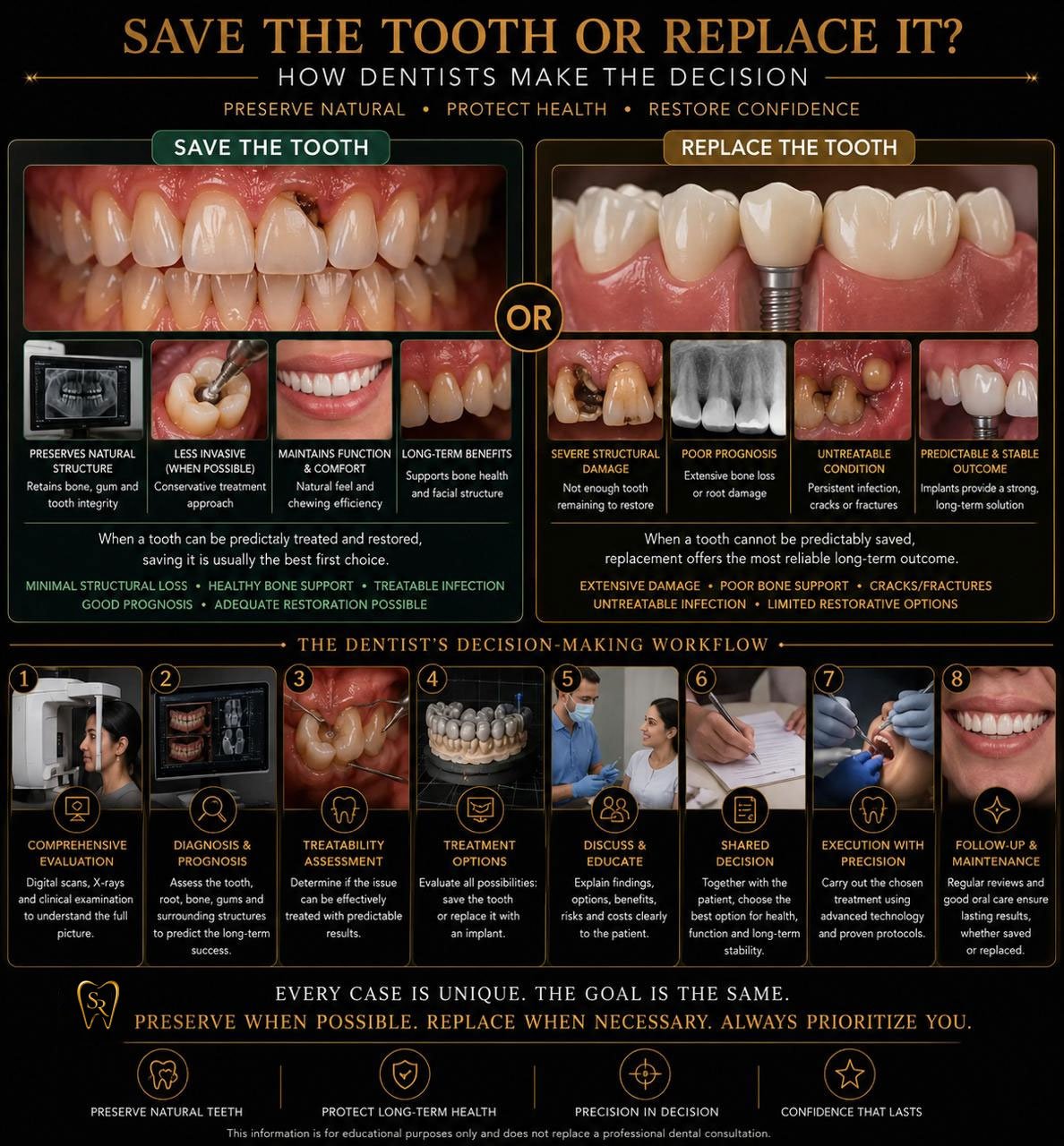 Save the Tooth or Replace It?