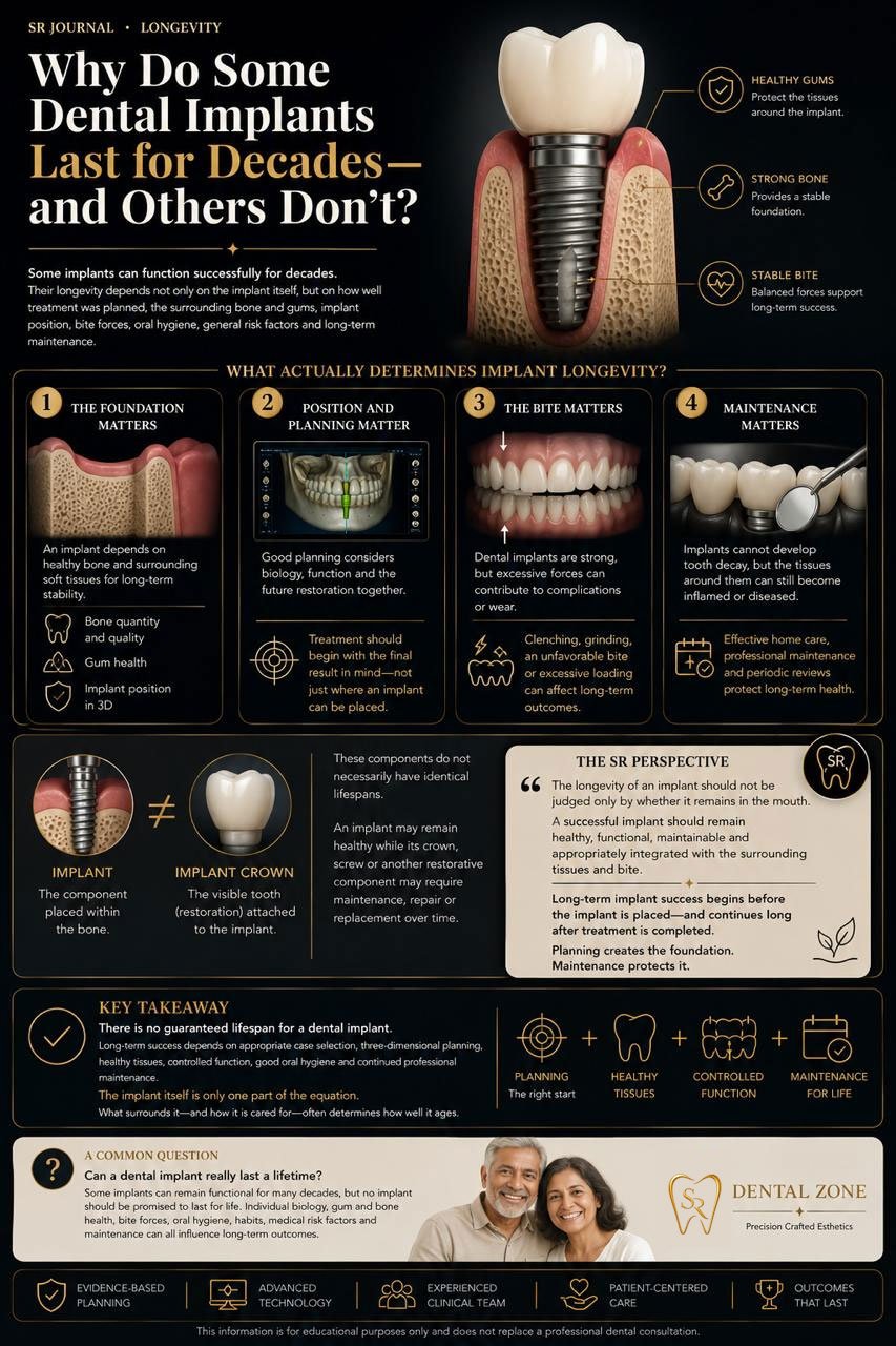 Why Do Some Dental Implants Last for Decades—and Others Don't?