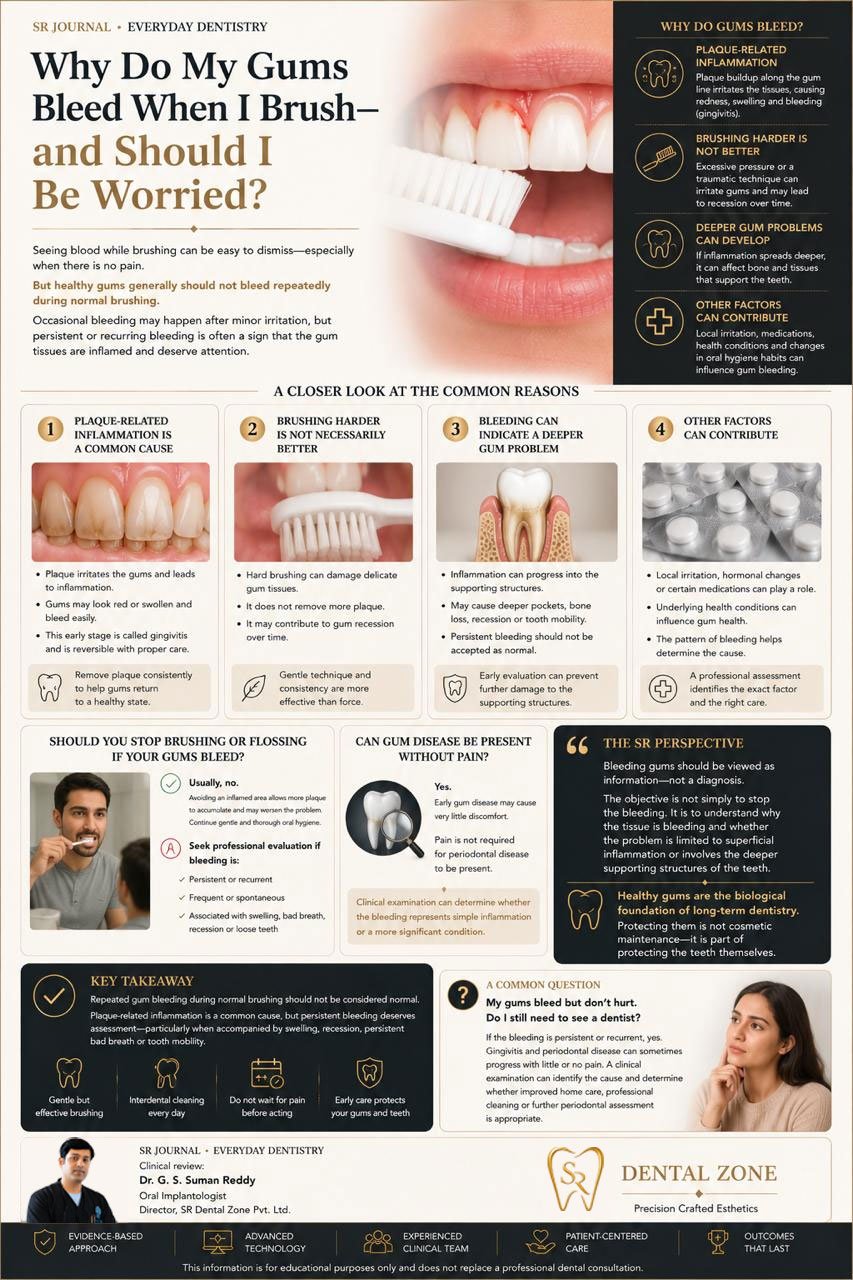 Why Do My Gums Bleed When I Brush?