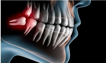 oral_maxilofacial surgery
