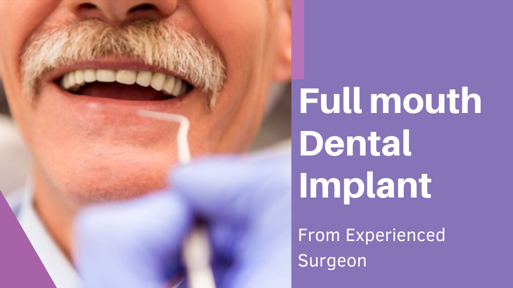 Full mouth dental implant from experienced surgeon