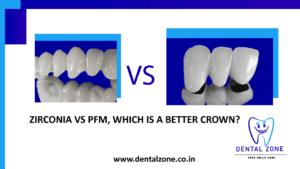 Zirconium Crown Vs PFM | Best Dental Crown | Dental Zone