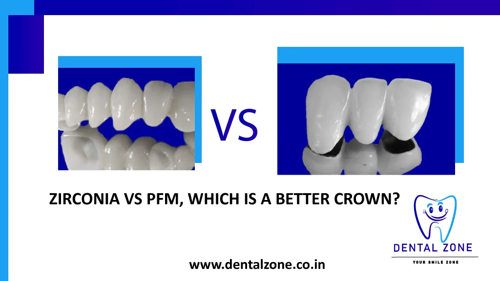 ZIRCONIA-VS-PFM, which is a better crown?