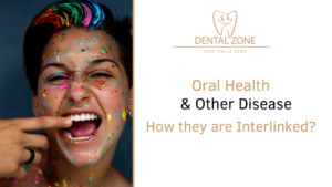 Oral Health and Other Disease